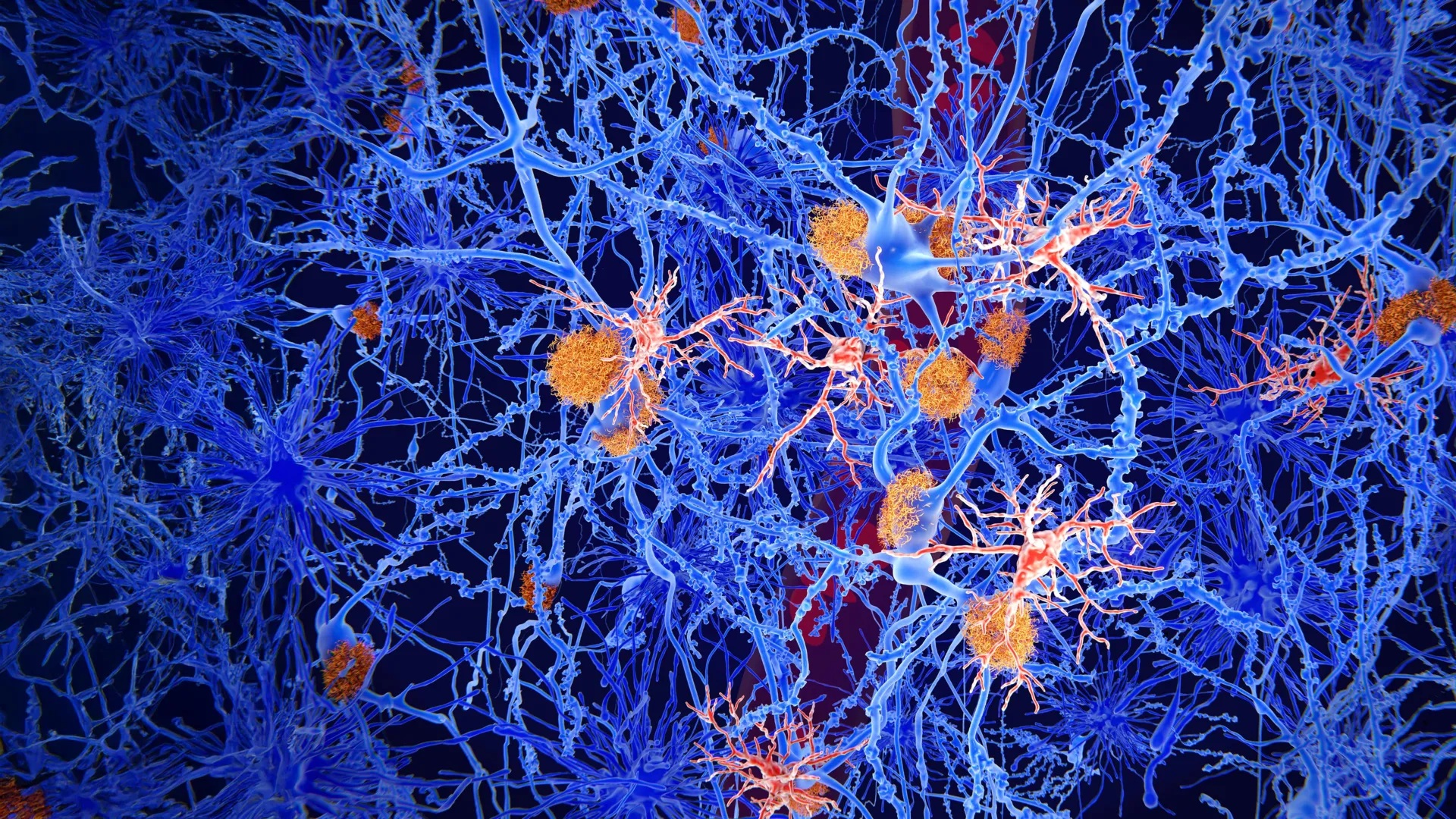 Một loại hợp chất mới có thể giúp tế bào miễn dịch của não chống lại bệnh Alzheimer, làm giảm mảng bám độc hại và cải thiện trí nhớ trong các nghiên cứu trên động vật - Ảnh: Shutterstock