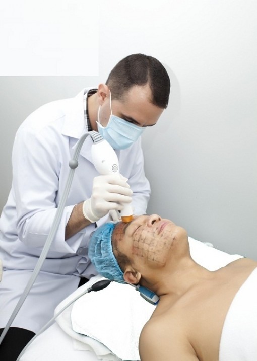 Thermage tại Thea Beauty Solutions giúp trẻ hóa đến 10 tuổi