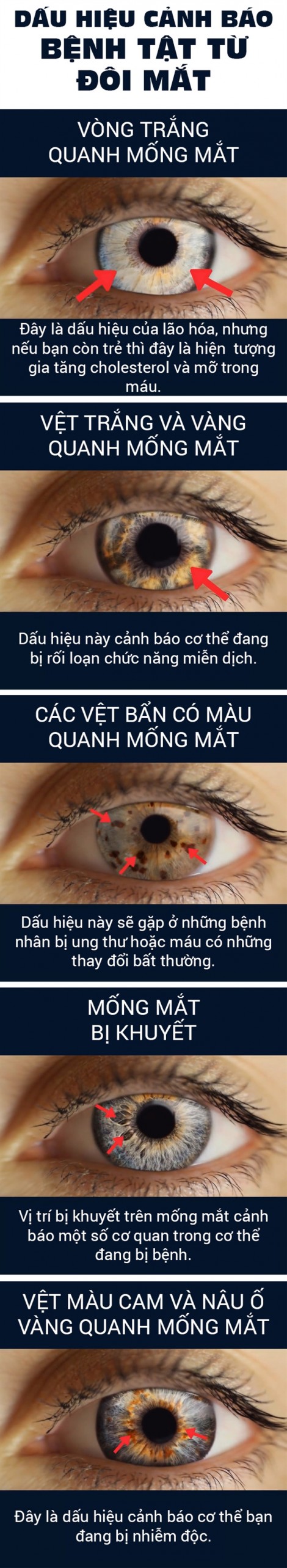 Những bệnh nguy hiểm bộc lộ qua đôi mắt