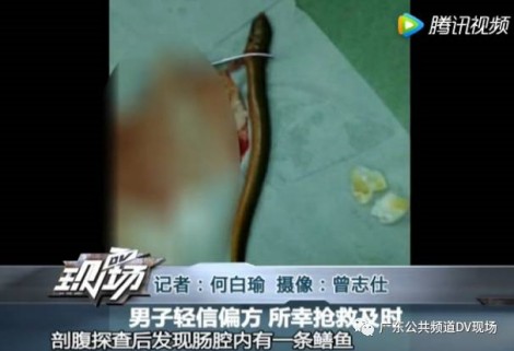 Cho lươn sống vào bụng để 'thông ruột', người đàn ông suýt mất mạng