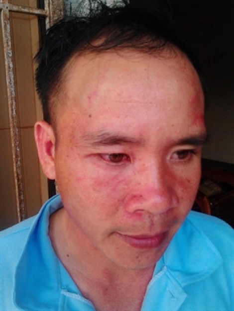 Đắk Lắk: Người dân bị hành hung, đe dọa sau khi 'tố' lò than gây ô nhiễm