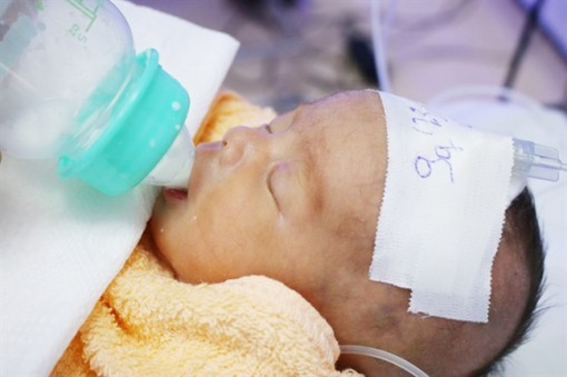 Bệnh viện quận Thủ Đức đỡ đẻ và nuôi dưỡng thành công trẻ sinh non chỉ 1,5kg