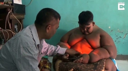 Bé trai 10 tuổi nặng 190kg vì nghiện nước ngọt và mì ăn liền