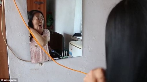 Người phụ nữ 'mặt voi' muốn tự sát vì phẫu thuật thất bại
