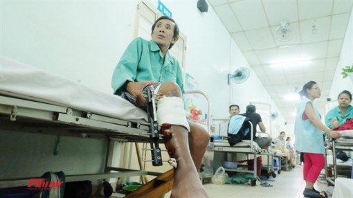 Không đủ tiền tháo khung cố định chân, bệnh nhân cắt bỏ đoạn xương