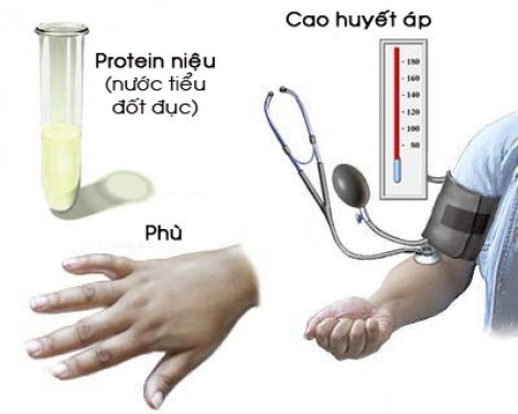 ADN của thai nhi ảnh hưởng nguy cơ tiền sản giật ở mẹ