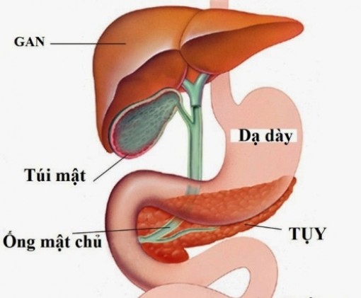 Hơn 10 năm không có tiền điều trị, một phụ nữ bị sỏi lấp đầy gan
