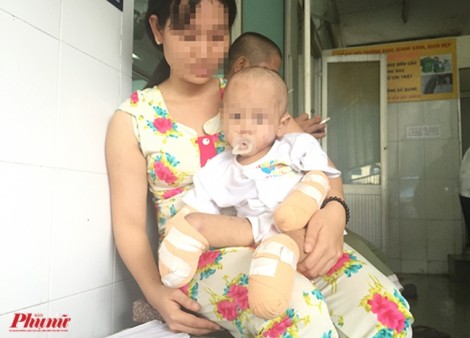 Bé gái 2 tuổi bị cắt bỏ hết tay chân sau cơn nóng sốt