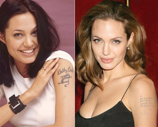 Xăm rồi xóa,  xóa rồi xăm