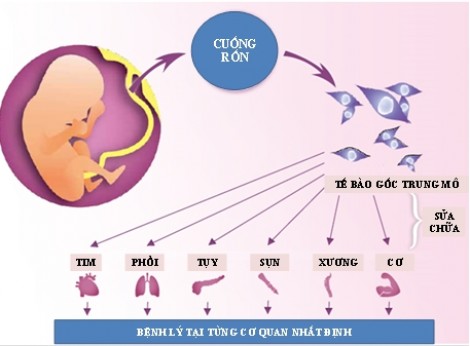 TP.HCM: Bệnh viện quận đầu tiên nhận giữ dây rốn cho trẻ sơ sinh