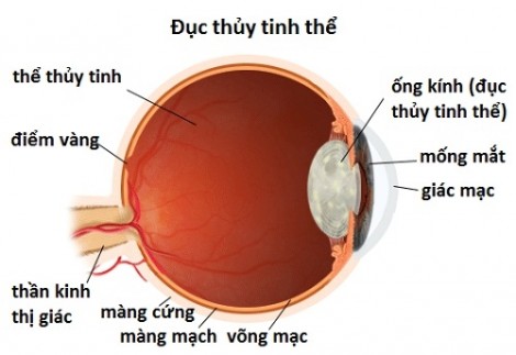 Đừng để rủi ro y khoa thành 'sự im lặng đáng sợ'