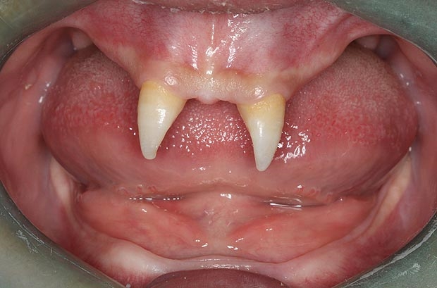 Những hàm răng kinh dị nhất thế giới - Báo Phụ Nữ