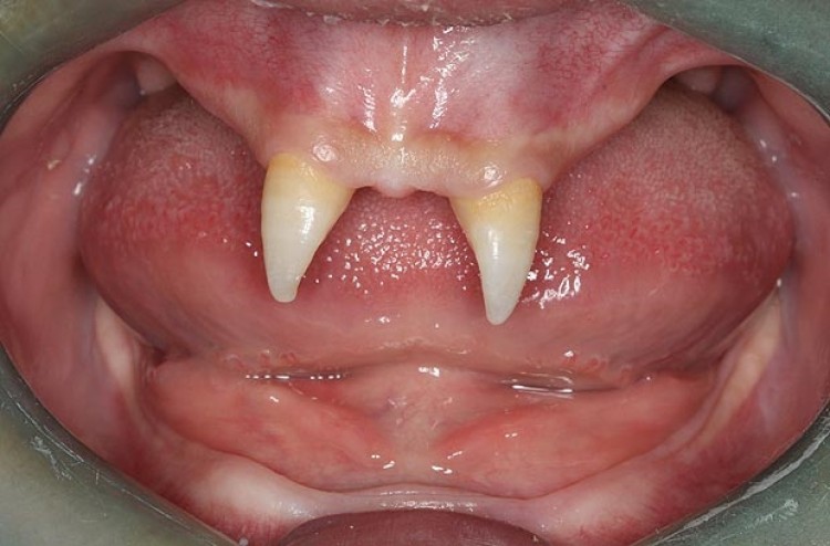 Có những trường hợp nào khác về hàm răng xấu nhất thế giới không?
