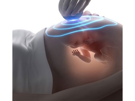 Sợ sóng siêu âm không đi khám, thai phụ đau đớn khi biết con chết lưu lúc nào không hay