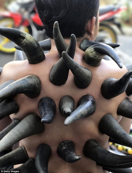 Kỳ lạ phương pháp giác hơi bằng sừng trâu