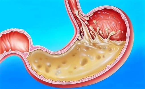 Cha mẹ hãy tránh xa loại thuốc này nếu thấy trẻ bị nôn trớ liên tục