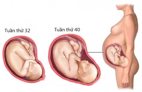 Thai nhi tử vong vì mẹ ăn quá nhiều đồ ngọt