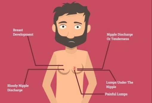 Nam giới có vú to dễ mắc nhiều bệnh nguy hiểm