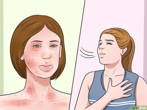5 dấu hiệu cho thấy bạn bị dị ứng kháng sinh