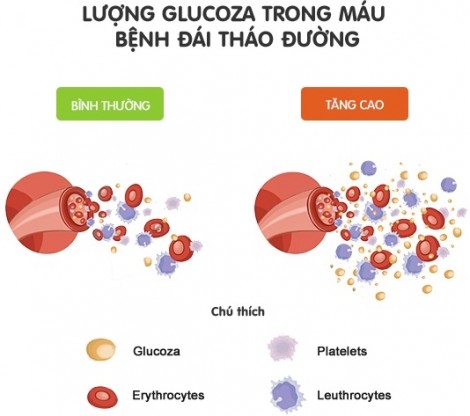 Đôi điều về ăn uống và bệnh đái tháo đường