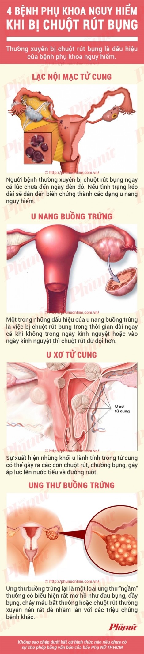 Đối diện với 4 bệnh phụ khoa nguy hiểm nếu thấy chuột rút cơ bụng