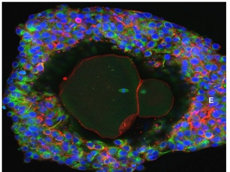 Lần đầu tiên, phát triển tế bào trứng người thành công trong phòng thí nghiệm