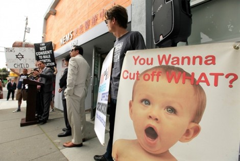Iceland cấm cắt bao quy đầu các bé trai