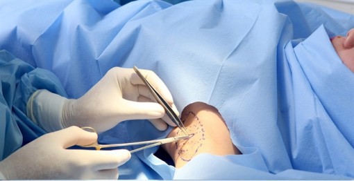 Lén chồng đi tân trang?