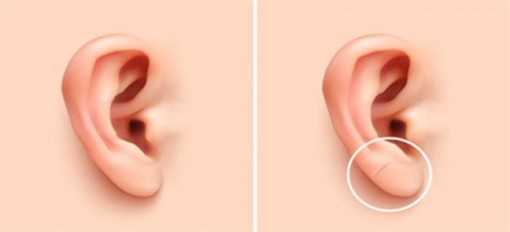 6 dấu hiệu kỳ lạ cảnh báo tim có vấn đề