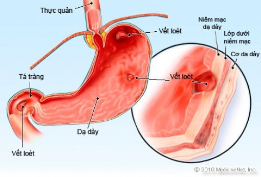 Nghiên cứu mới điều trị căn bệnh 70% người Việt có nguy cơ mắc phải