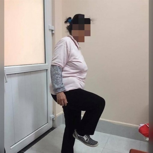 Nữ bệnh nhân ở Hà Nội 20 năm tự uống 'vài chục kg' corticoid để chữa bệnh