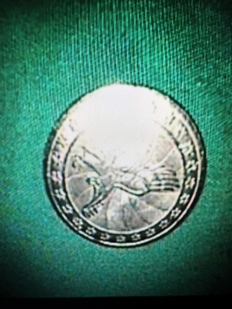 Gắp đồng xu 2,3cm trong dạ dày bé 4 tuổi