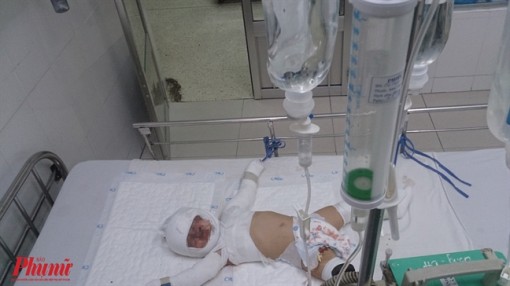 Nổ bình gas trong lúc nấu ăn, hai mẹ con nhập viện