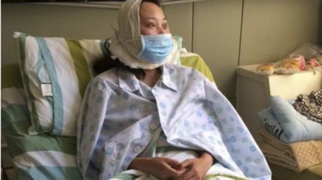 Phẫu thuật ‘để làm người mẫu’, nữ sinh viên bị lừa 11.000 USD