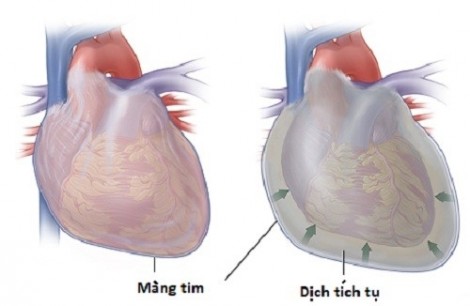 Người phụ nữ bị cửa tự động ép chặt vào tường