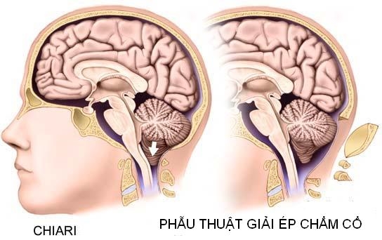 Nu ca si 24 tuoi dot quy tren san khau vi 'nao tran ra khoi hop so'