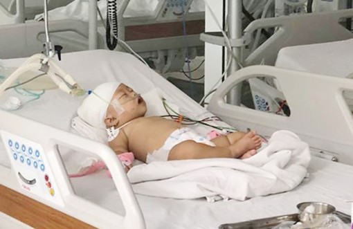 Khỉ hàng xóm xổng chuồng tấn công bé gái lún sọ