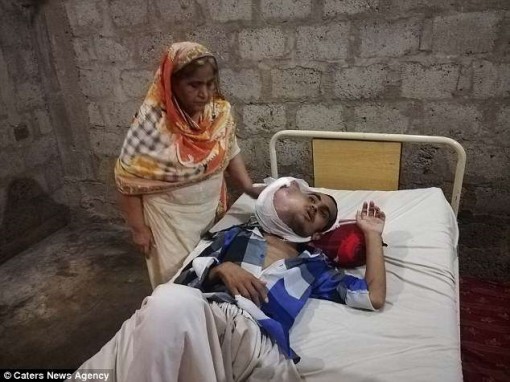 Nha sĩ dỏm nhổ răng, nam thanh niên 21 tuổi bị ung thư miệng