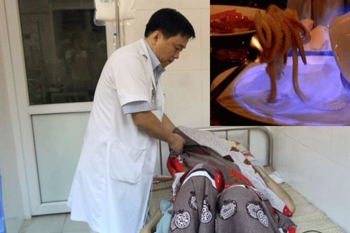 Nướng mực bằng cồn, thiếu niên 16 tuổi ở Hà Nội cháy mặt