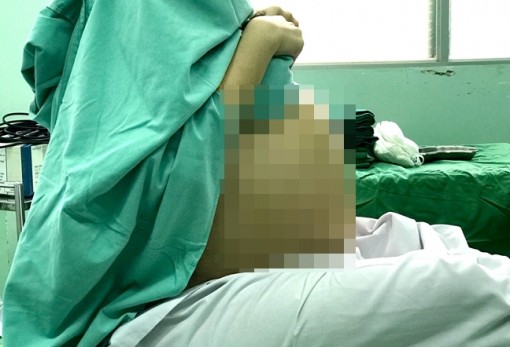 Bụng to bất thường, cô gái 20 tuổi đi khám phát hiện u buồng trứng 7kg