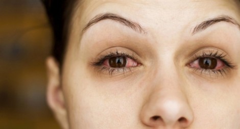 5 nguyên nhân khiến bạn bị đau mắt
