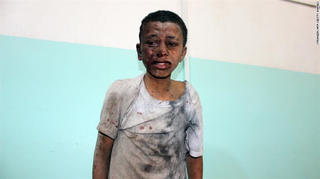 Tham kich khong kich nham tai Yemen: Nhung tieng cuoi cuoi cung truoc khi bom no