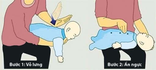 Giải mã các trường hợp tử vong do hóc dị vật