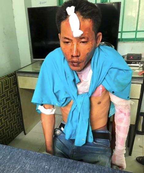 Hai người con bị cha dượng tẩm xăng đốt ở Đồng Nai đã tử vong