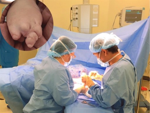 Dây chằng màng ối dính chặt khiến bé gái sinh ra không có ngón tay