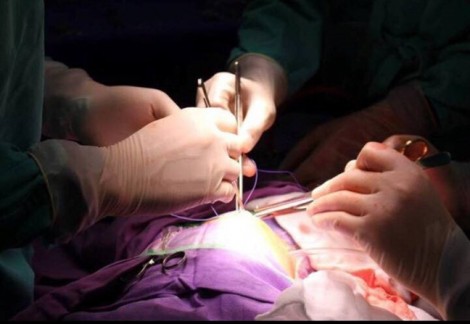Phẫu thuật thành công cho trẻ sơ sinh không có hậu môn