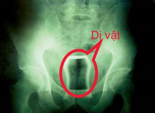 Những pha 'nghịch dại' nhớ đời của quý ông