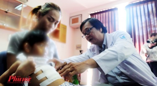 Nữ sinh lớp 9 nghiện nhổ tóc đến hói đầu, bác sĩ đưa ra giải pháp bất ngờ