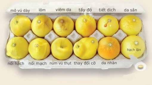 Mẹ mang thai điều trị ung thư, con có bị ảnh hưởng không?