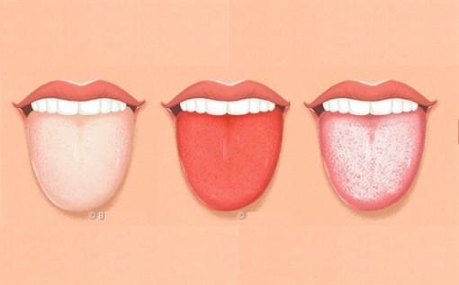 Nhìn lưỡi, biết được tình trạng sức khỏe